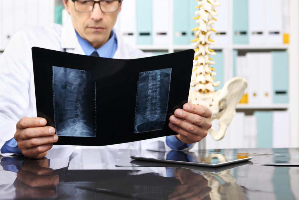Physiotherapy relieves back pain and sciatica through targeted exercises, therapy