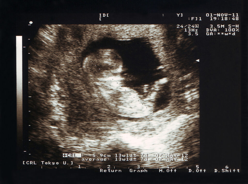 Understanding pregnancy weight gain supports maternal health and baby’s development