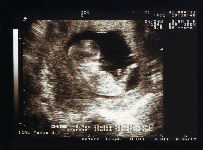 Understanding pregnancy weight gain supports maternal health and baby’s development