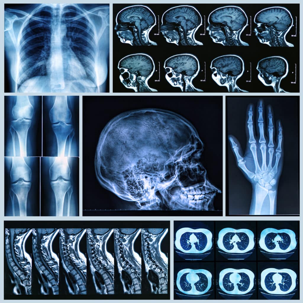 X-Ray images reveal internal structures, aiding accurate diagnosis and treatment