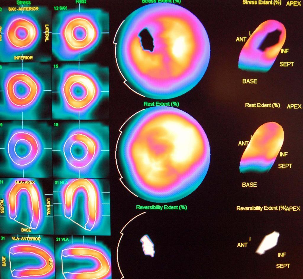 Recent developments in cardiac imaging enhance diagnosis, precision, and personalised treatment through advanced technologies