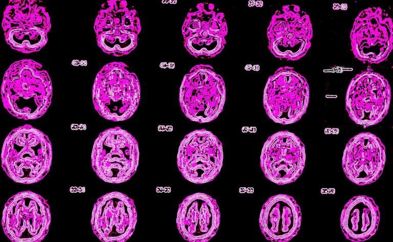 Nuclear medicine advances diagnostics, treatment, and patient care in modern healthcare