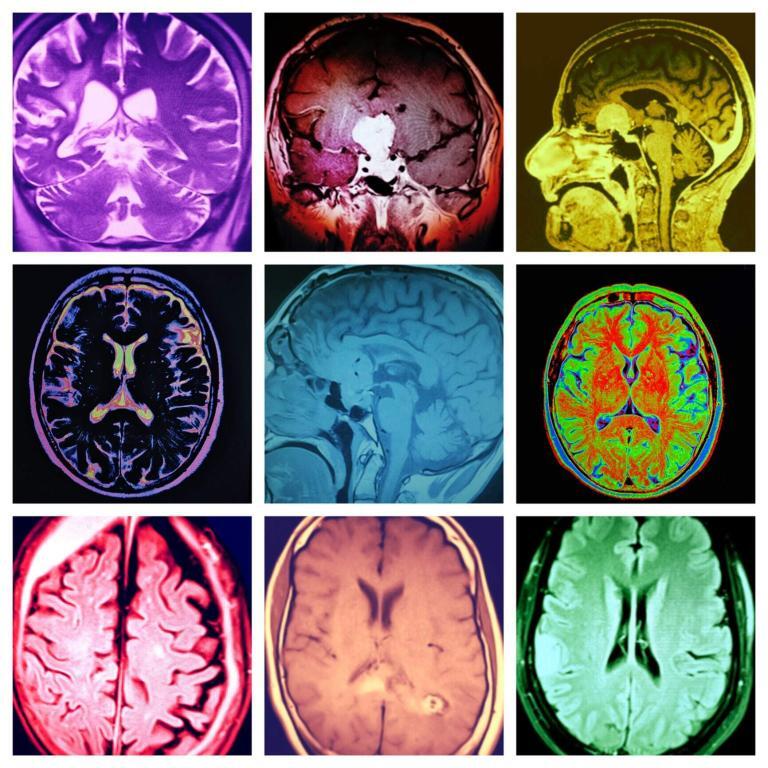 Understanding different MRI types enhances diagnostics, treatment planning, and medical research applications