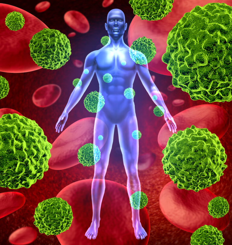 A breakthrough in metastatic prostate cancer treatment improves survival and therapeutic precision