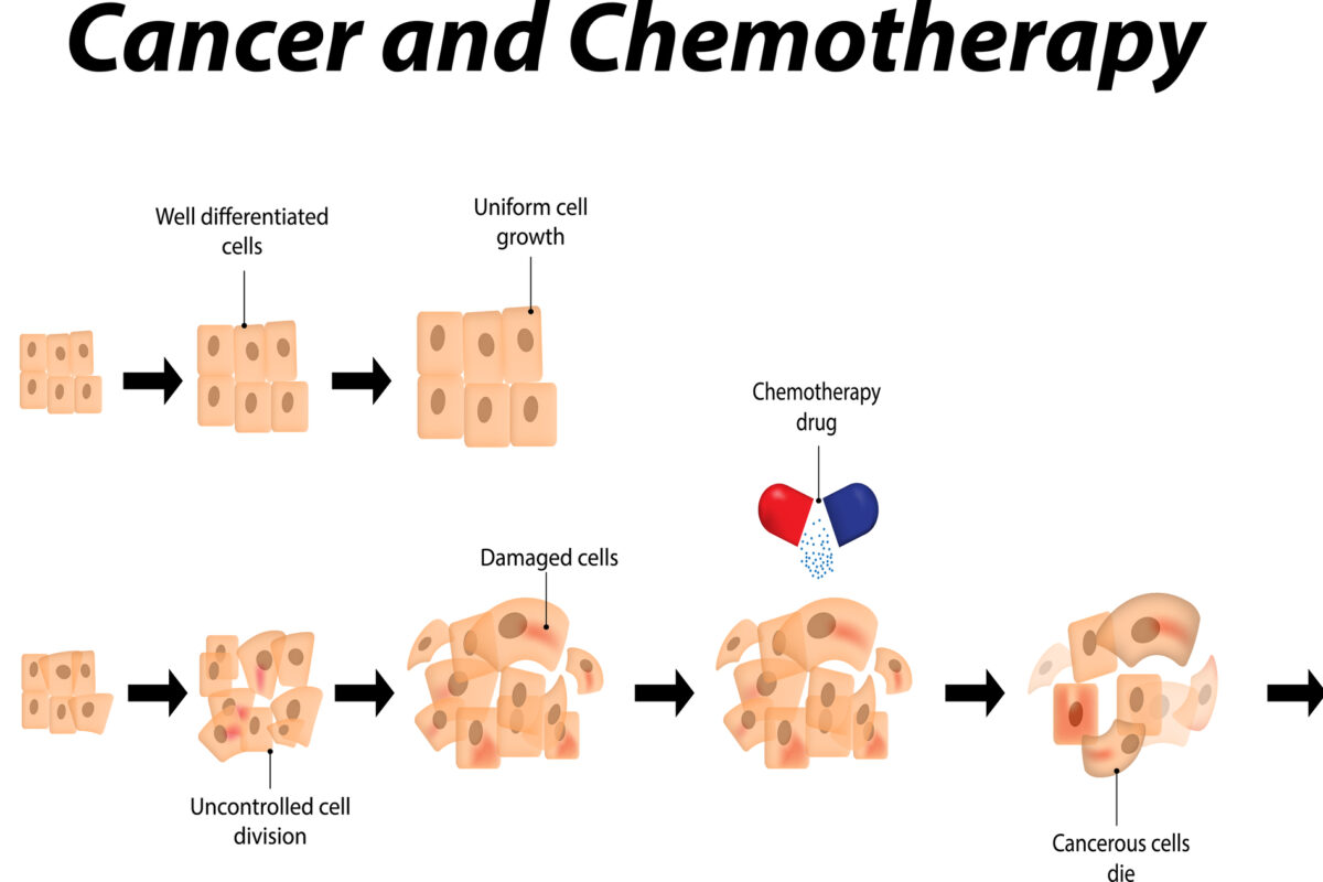 Chemotherapy uses powerful drugs to destroy or control cancer cells