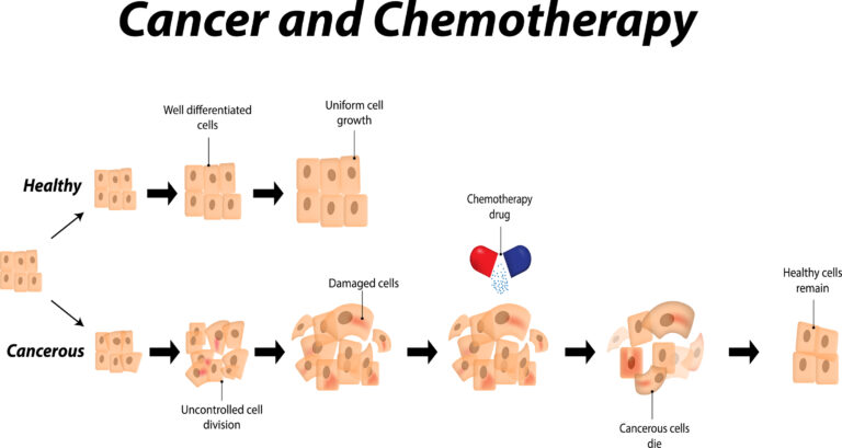Chemotherapy uses powerful drugs to destroy or control cancer cells