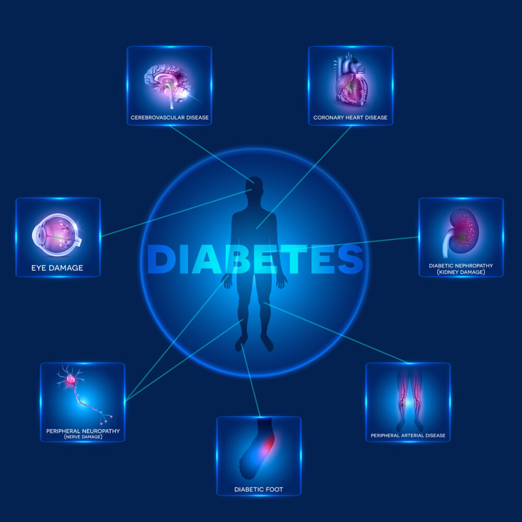 Medical imaging aids diagnosis and monitoring of all diabetes types