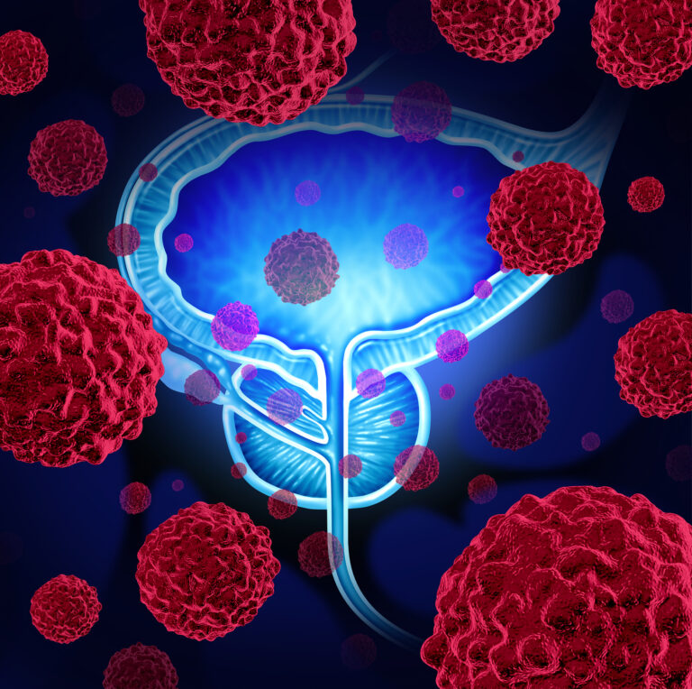 PSMA-targeting agents enhance prostate cancer imaging, diagnosis, and precision radiotherapy effectiveness