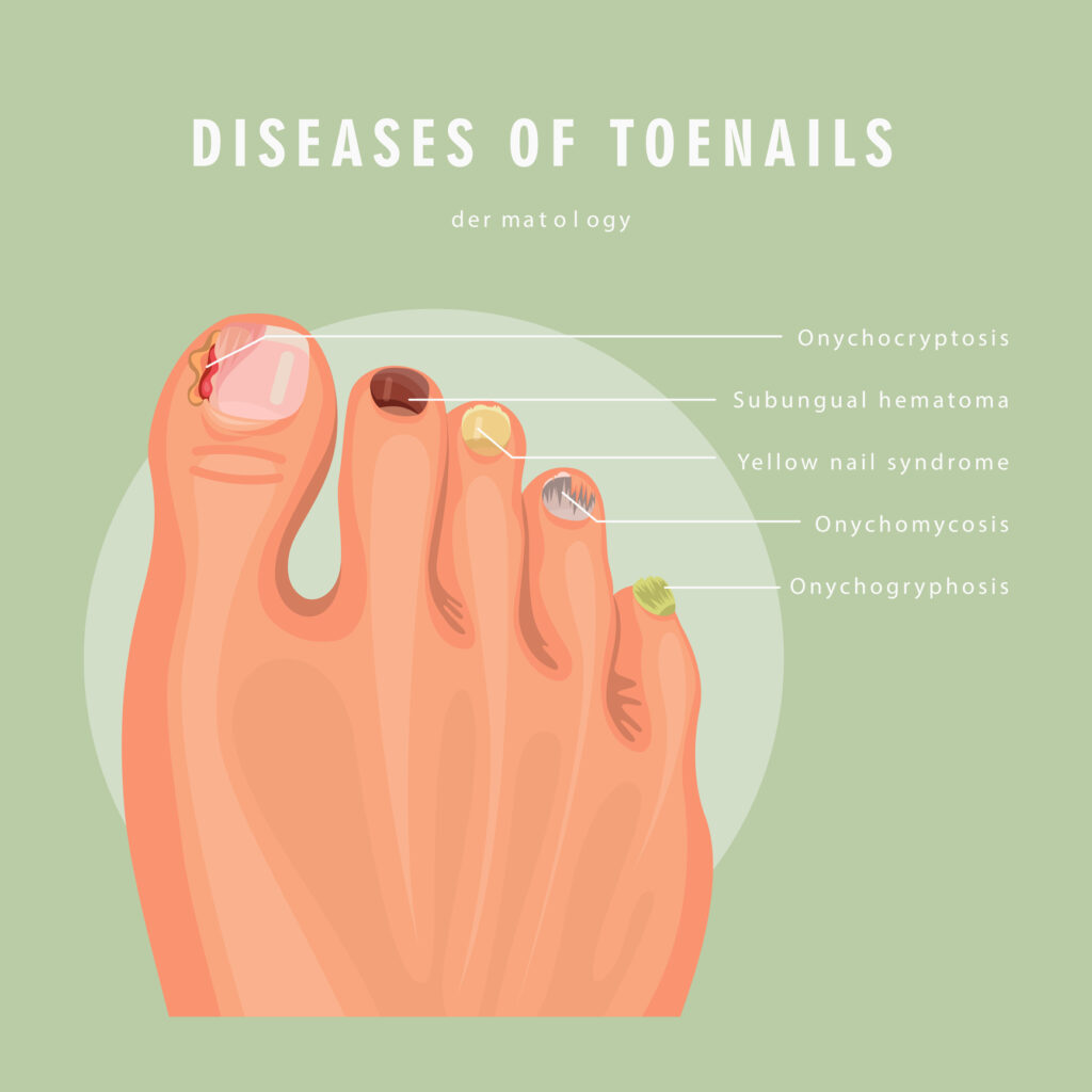 Natural remedies are gentler, pharmaceutical treatments often work more quickly