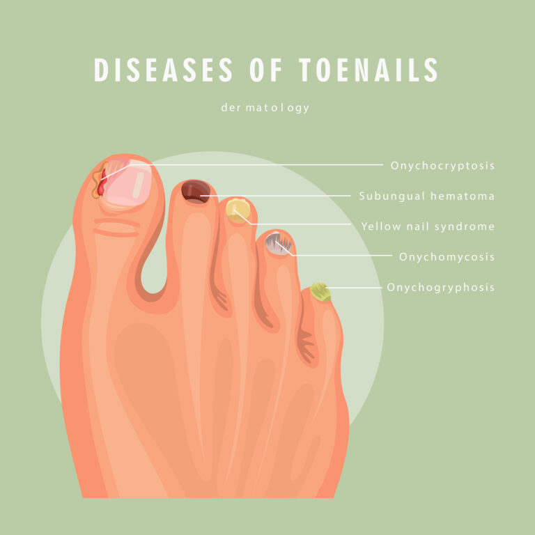 Natural remedies are gentler, pharmaceutical treatments often work more quickly