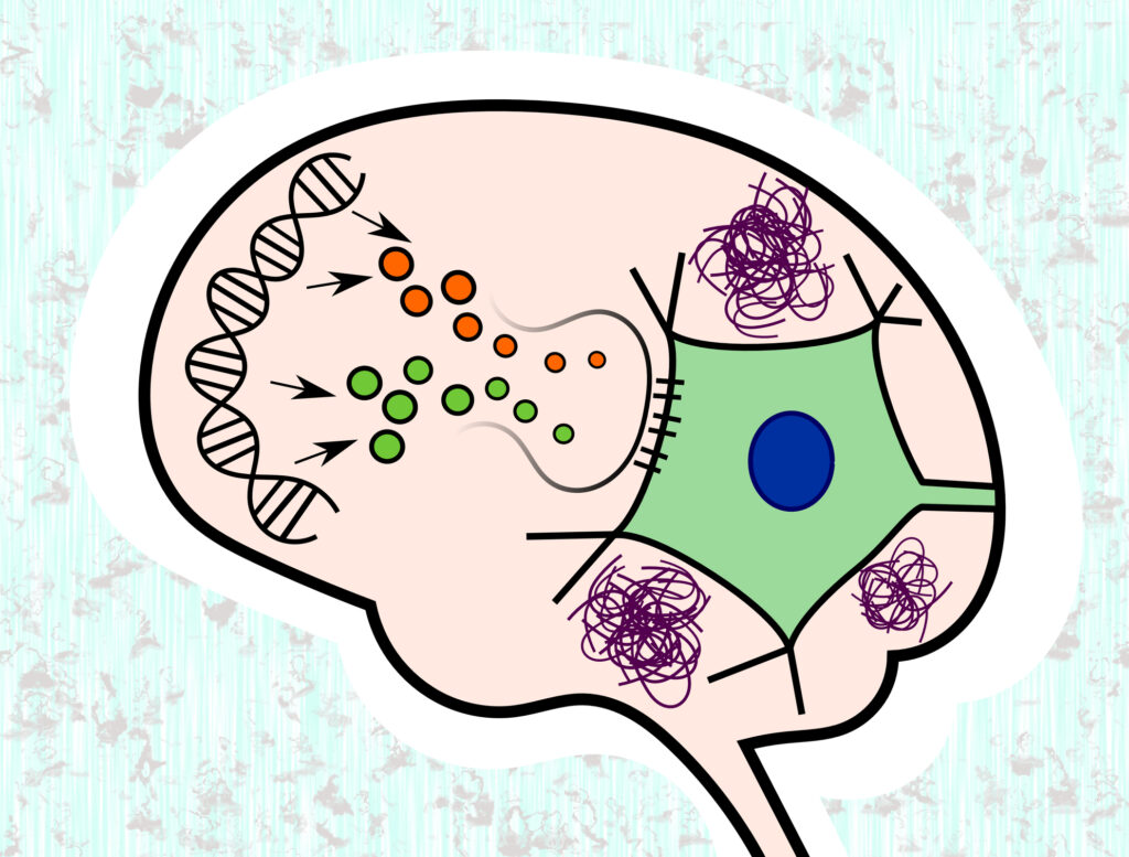 Clinical trials on memory loss help develop future Alzheimer’s treatments
