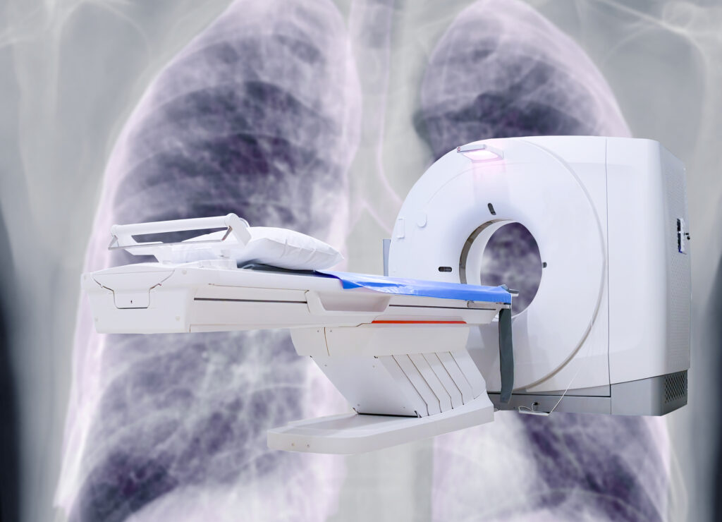 Dark field computed tomography reveals microstructural details invisible to conventional scans