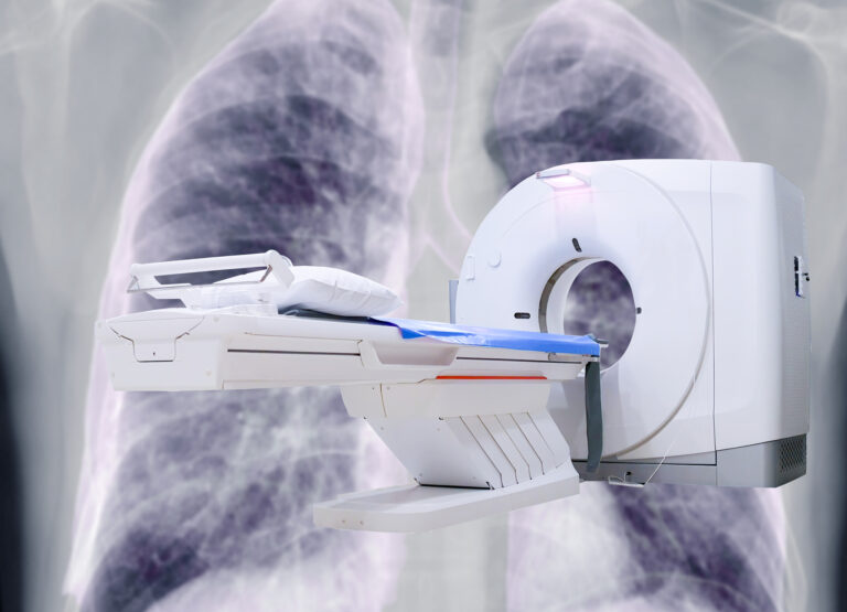 Dark field computed tomography reveals microstructural details invisible to conventional scans