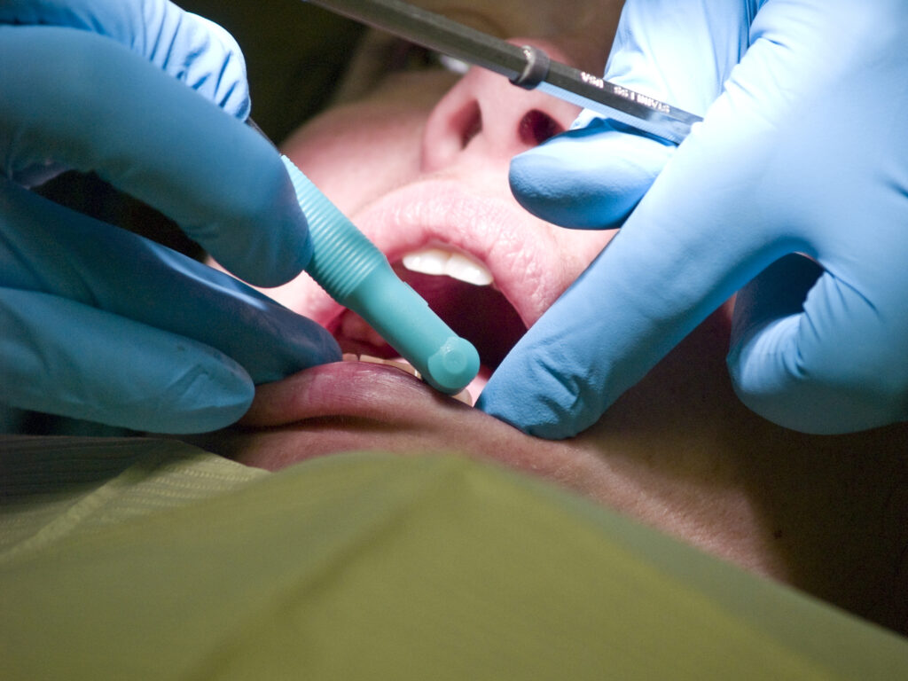 Dental anxiety affects millions, causing fear, stress, and avoidance of treatment