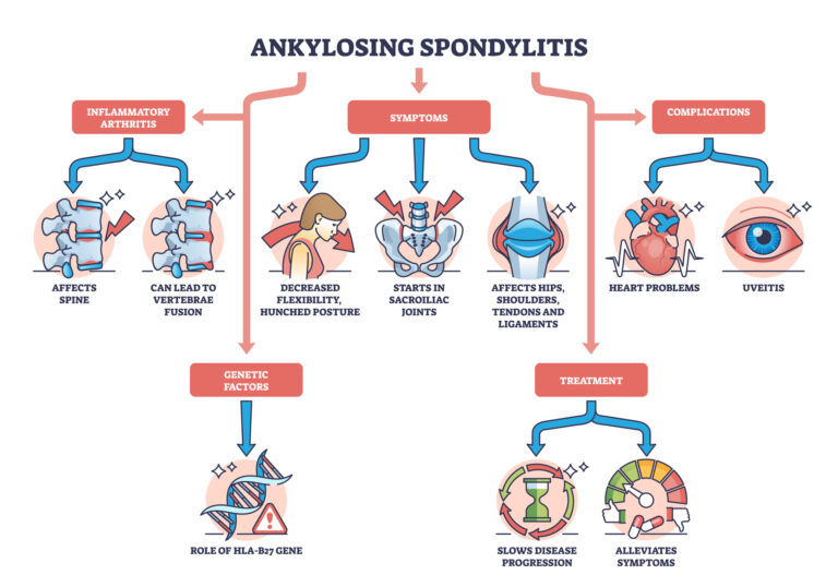 Genetic factors significantly influence susceptibility to common chronic back problems