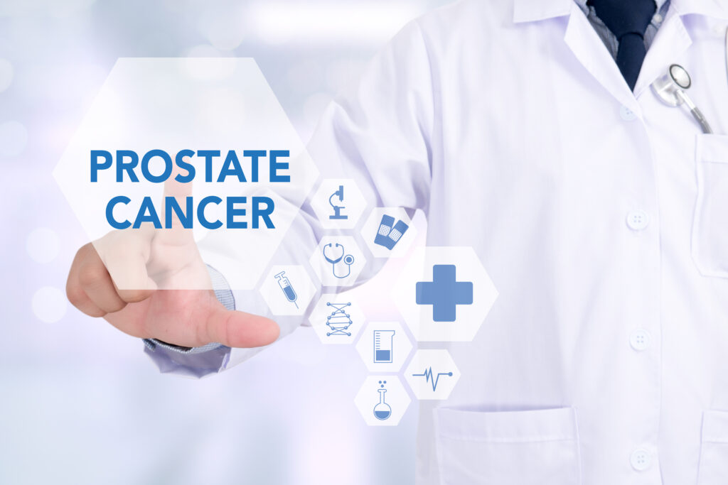 Treatment options for metastatic castration-resistant prostate cancer include chemotherapy