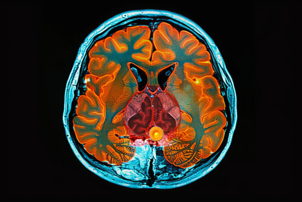 Nuclear neurology applies imaging techniques to study brain function disorders