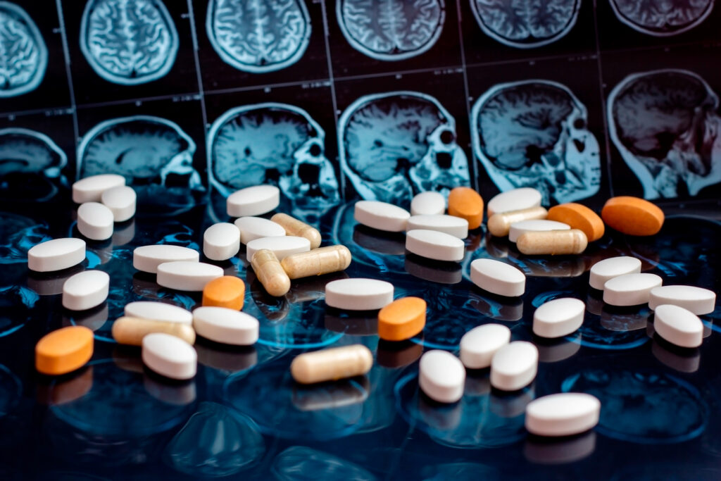 Radiology reveals brain changes, guiding personalised treatment for addiction recovery