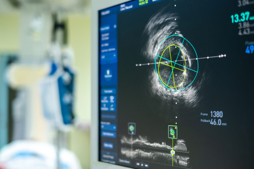 Micro-ultrasound provides high-resolution, real-time imaging for improved medical diagnostics