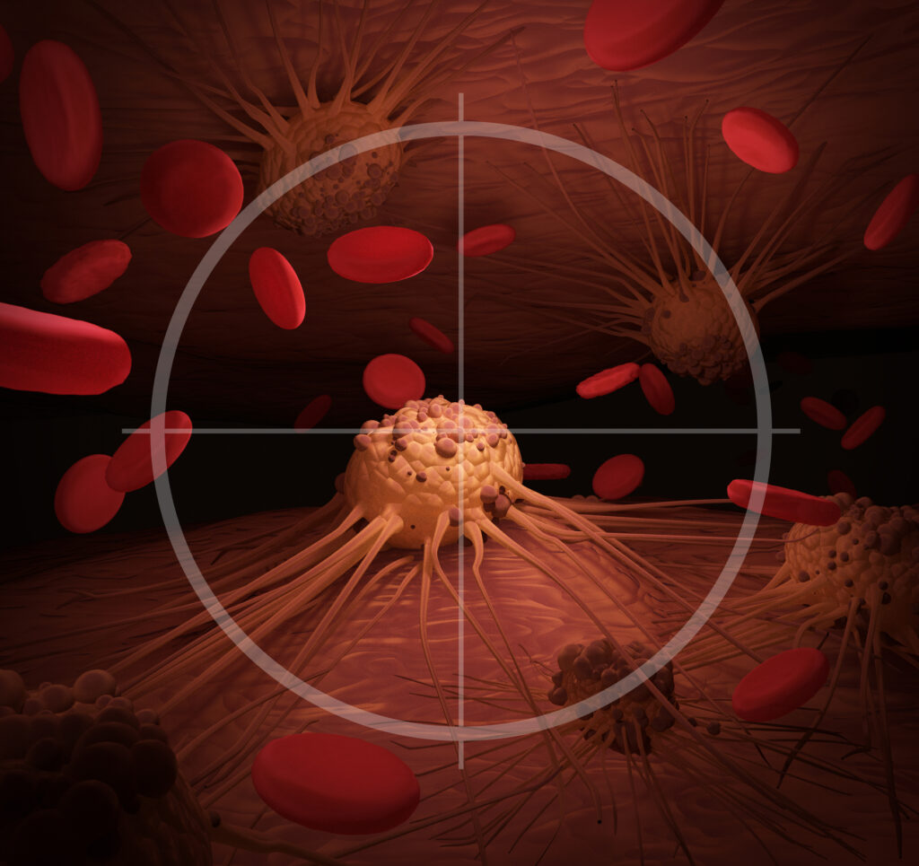 Actinium-225 DOTATOC offers targeted alpha therapy for refractory GEP-NETs