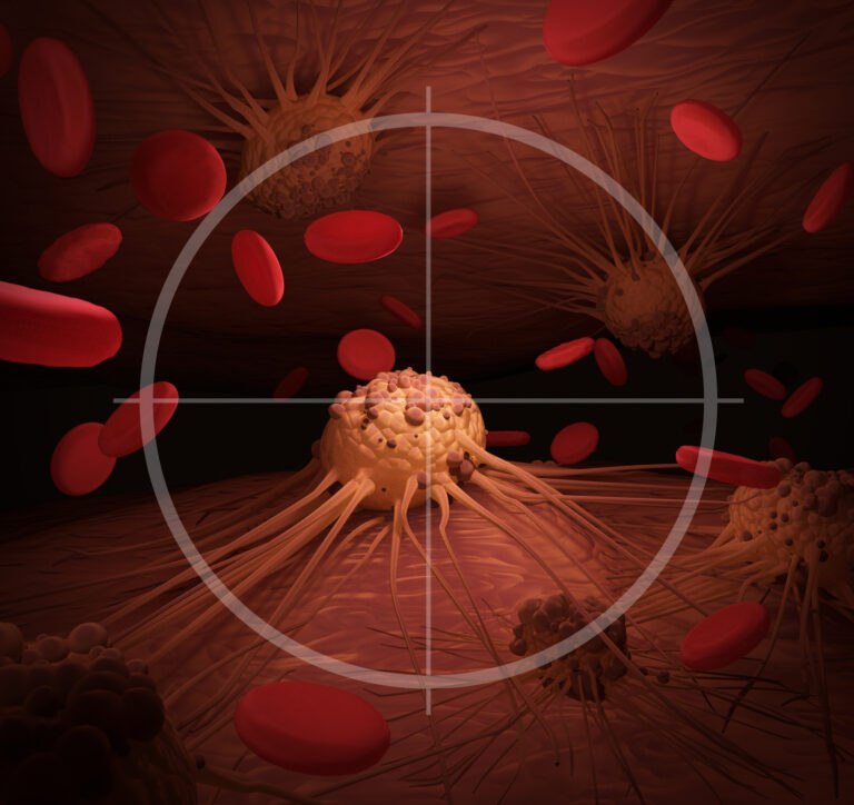 Actinium-225 DOTATOC offers targeted alpha therapy for refractory GEP-NETs