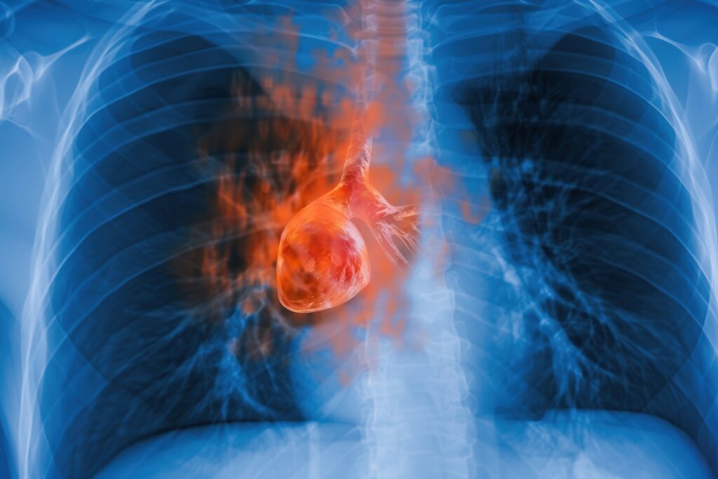 X-ray phase-contrast imaging visualises soft tissues with superior contrast