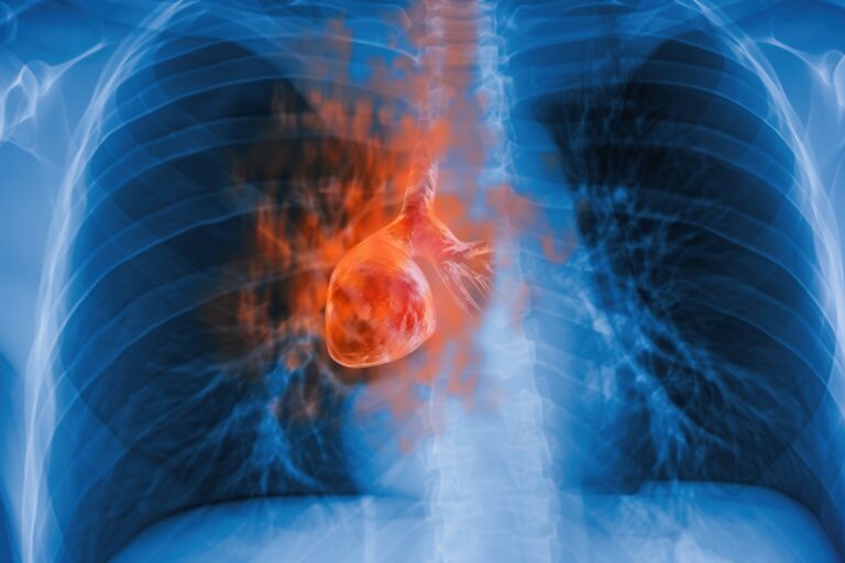 X-ray phase-contrast imaging visualises soft tissues with superior contrast