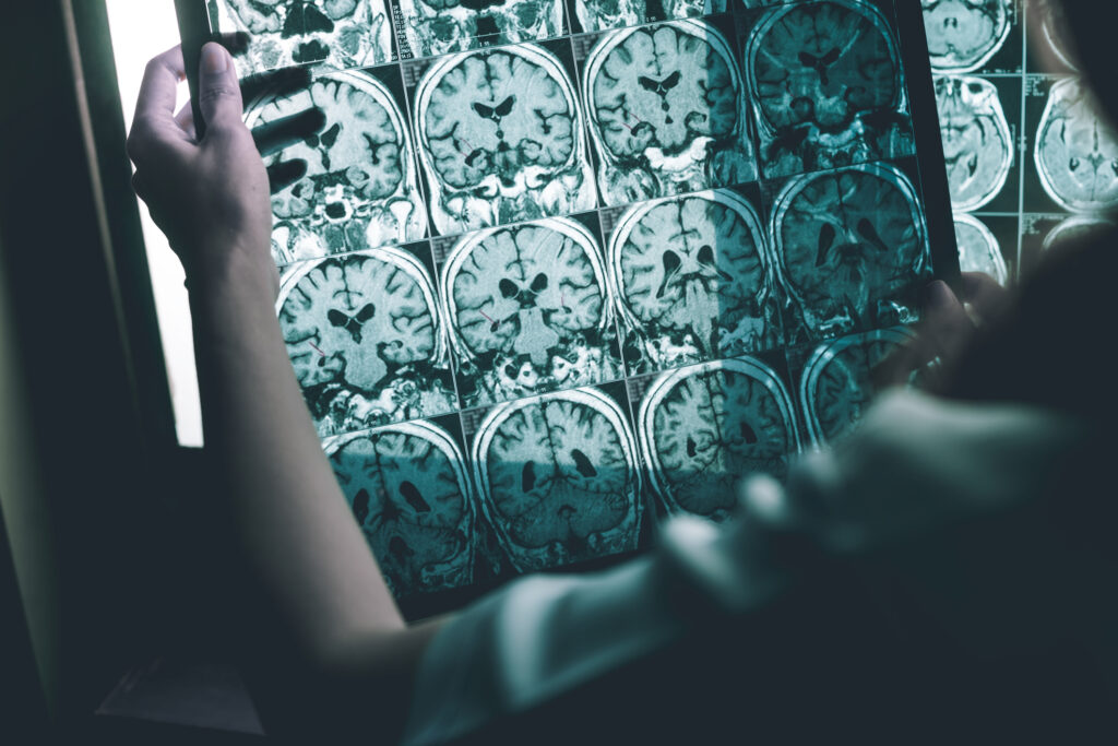 Editorial review 2016 nuclear medicine, diagnostic imaging and therapy