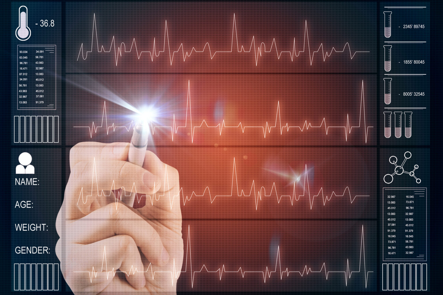 Artificial Intelligence in electrocardiography improves diagnosis, prediction, and cardiac monitoring
