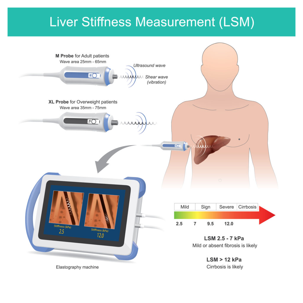 Elastography offers diverse clinical applications, enhancing diagnosis and treatment precision