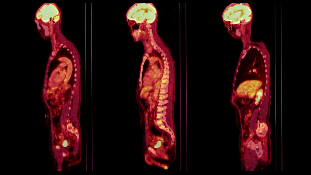 Radioactive imaging reveals hidden biological processes for diagnosis and research