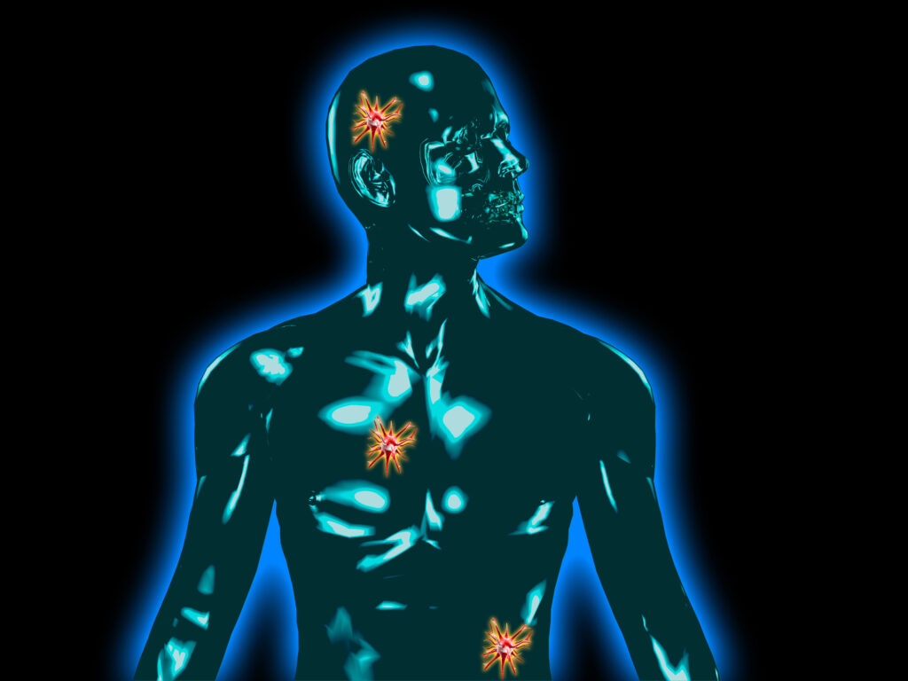 Radiotheranostics Radiotheranostics combines diagnosis and therapy targeting with radiolabelled compounds