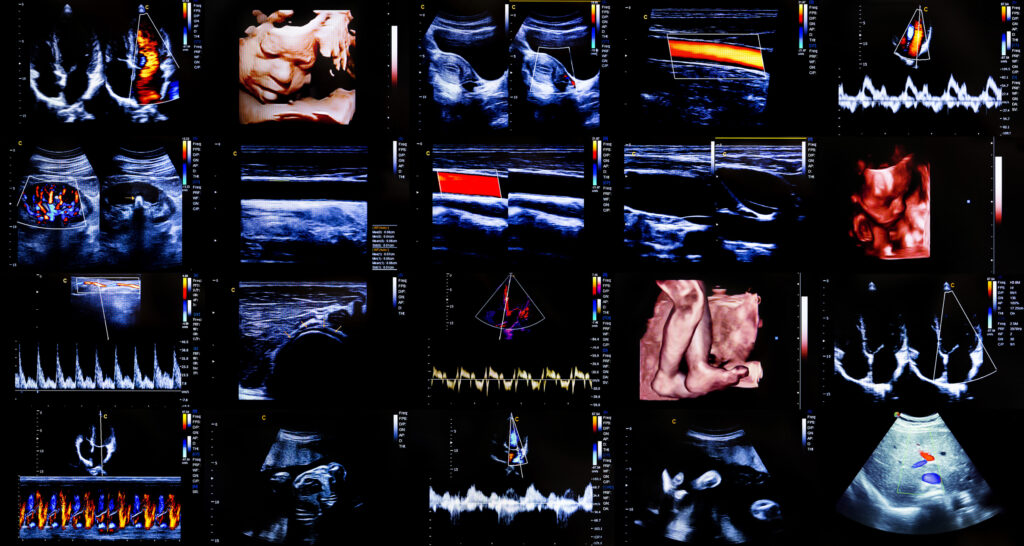 Seeing with ultrasound reveals hidden structures using sound, not light