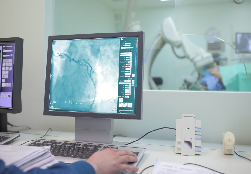 Angiography Angiogram X-rays clearly visualize the heart's intricate blood vessels