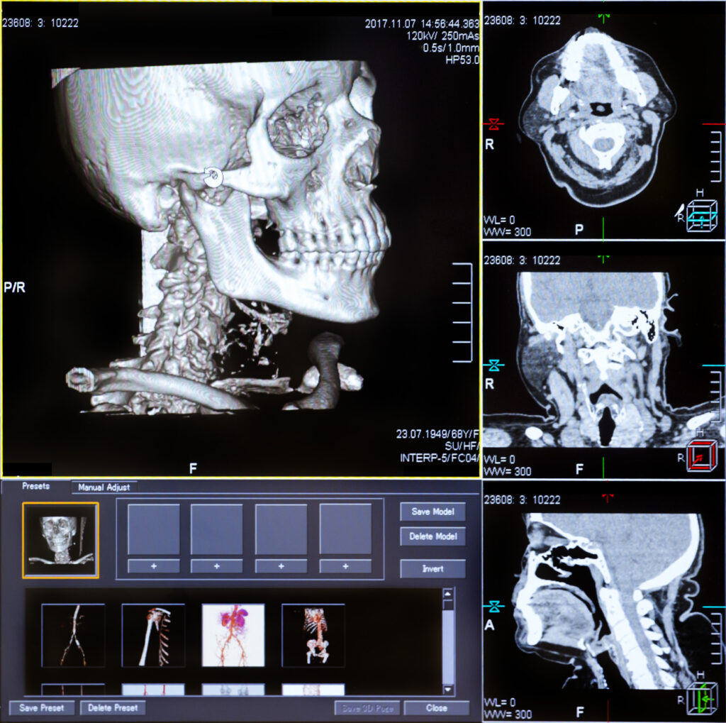 This article explores advancements optimising diagnostic imaging quality and safety