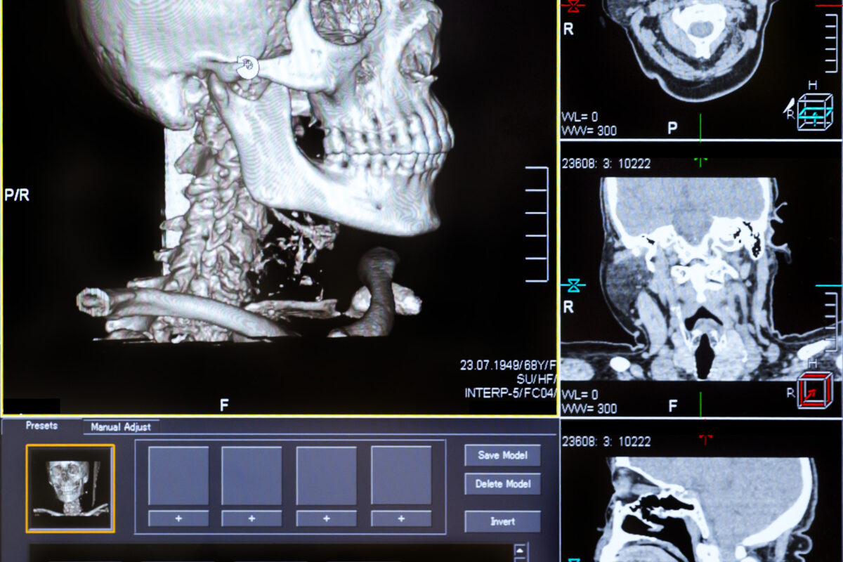 This article explores advancements optimising diagnostic imaging quality and safety