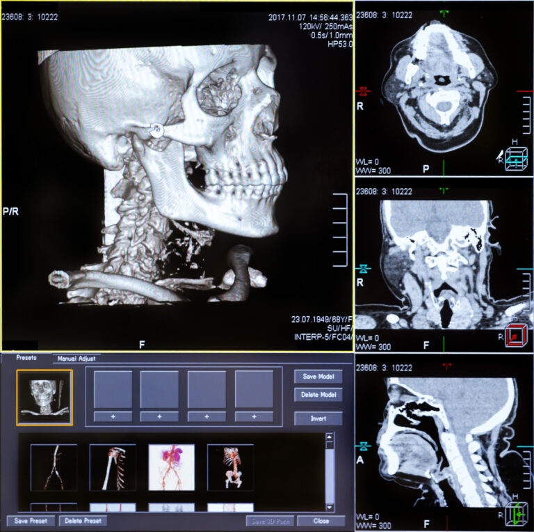 This article explores advancements optimising diagnostic imaging quality and safety