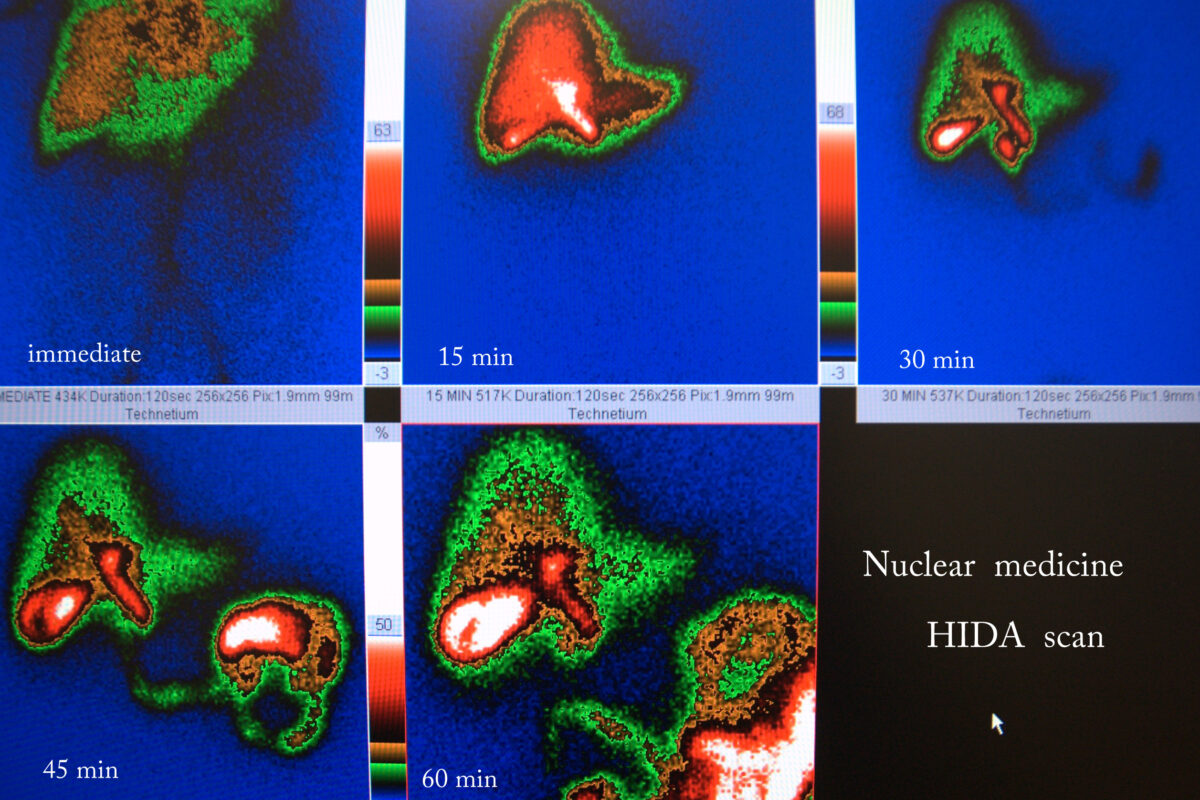 Building trust in nuclear medicine requires clearer, stronger, and consistent regulation