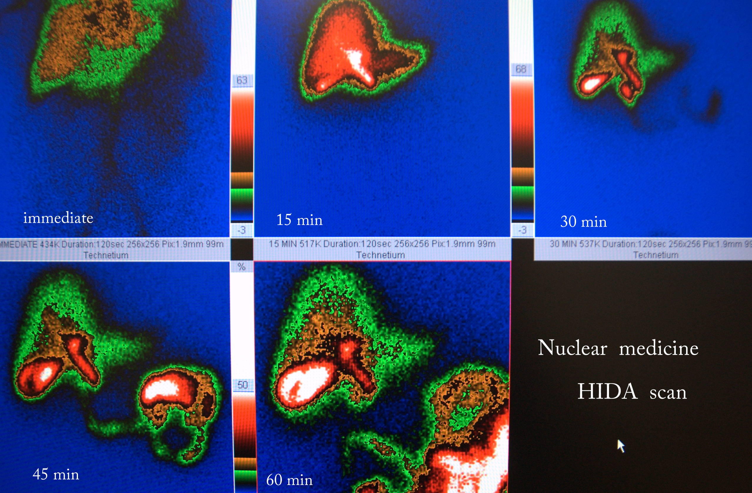 Building trust in nuclear medicine requires clearer, stronger, and consistent regulation