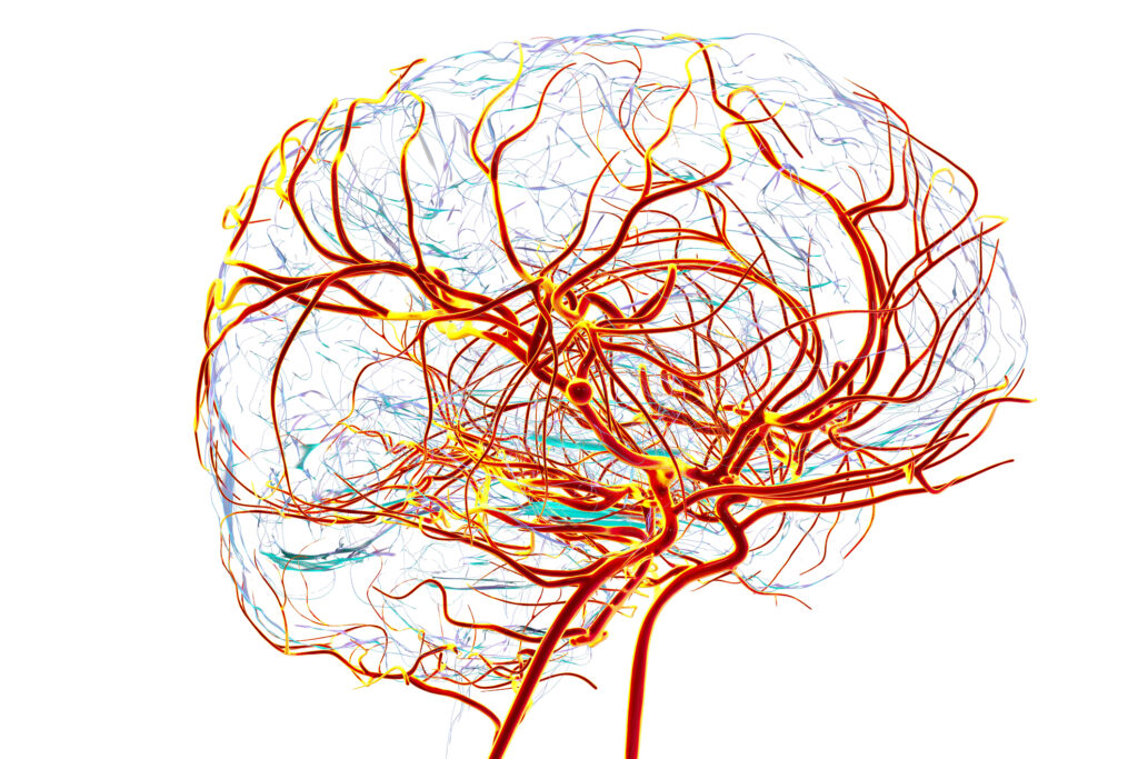 AI ensemble model improves acute intracranial haemorrhage detection accuracy