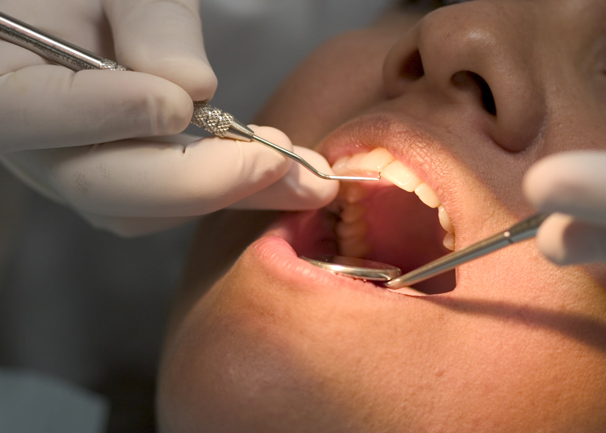 Regular dental check-ups help maintain healthy teeth and prevent costly treatments