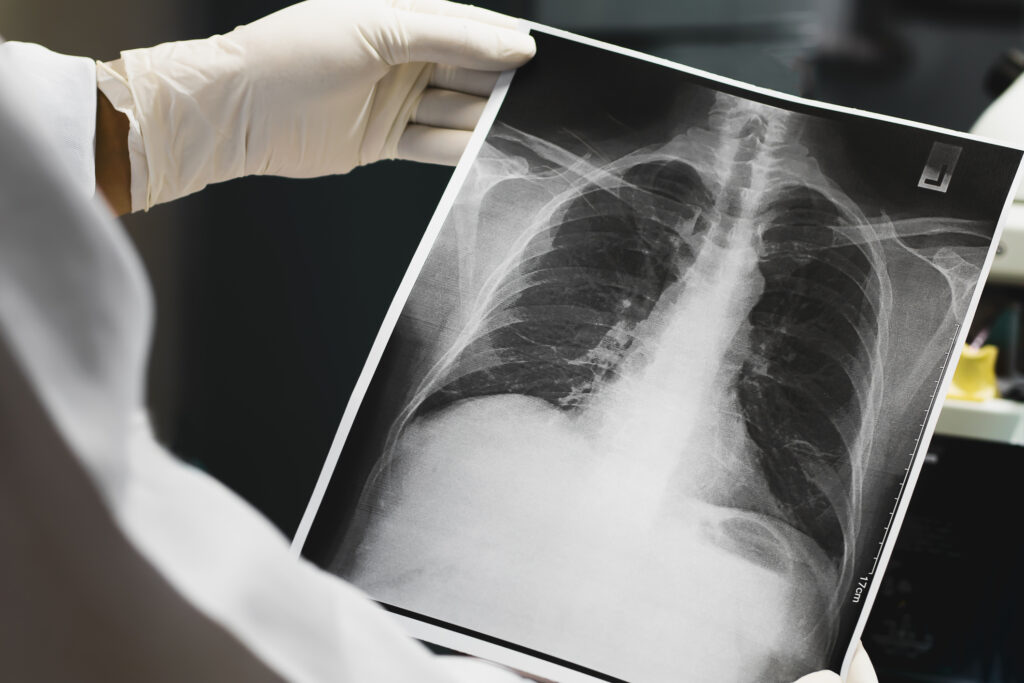X-ray imaging in practice reveals anatomy, guiding accurate medical diagnoses