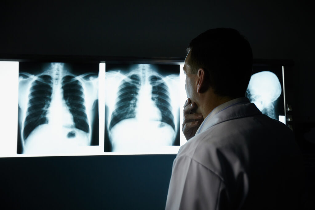 Radiology detects hidden risks early, improving preventive health for adults