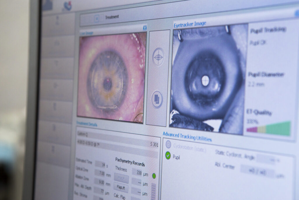 Contoura Vision LASIK in Houston delivers personalised, precise vision correction outcomes
