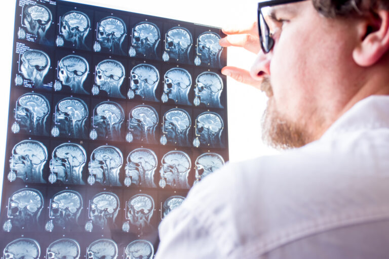 Advanced MRI sequences improve diagnosis and monitoring of multiple sclerosis