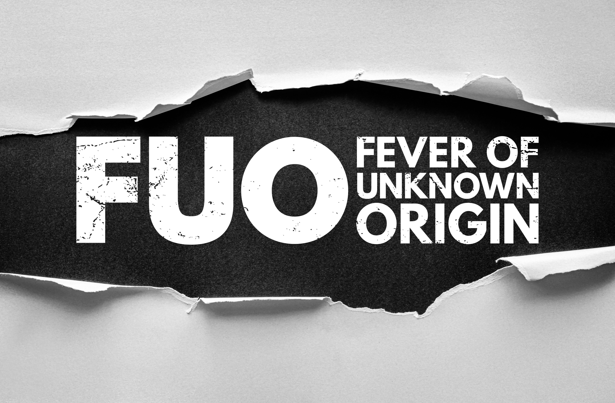 FDG PET-CT significantly improves diagnostic accuracy in fever of unknown origin