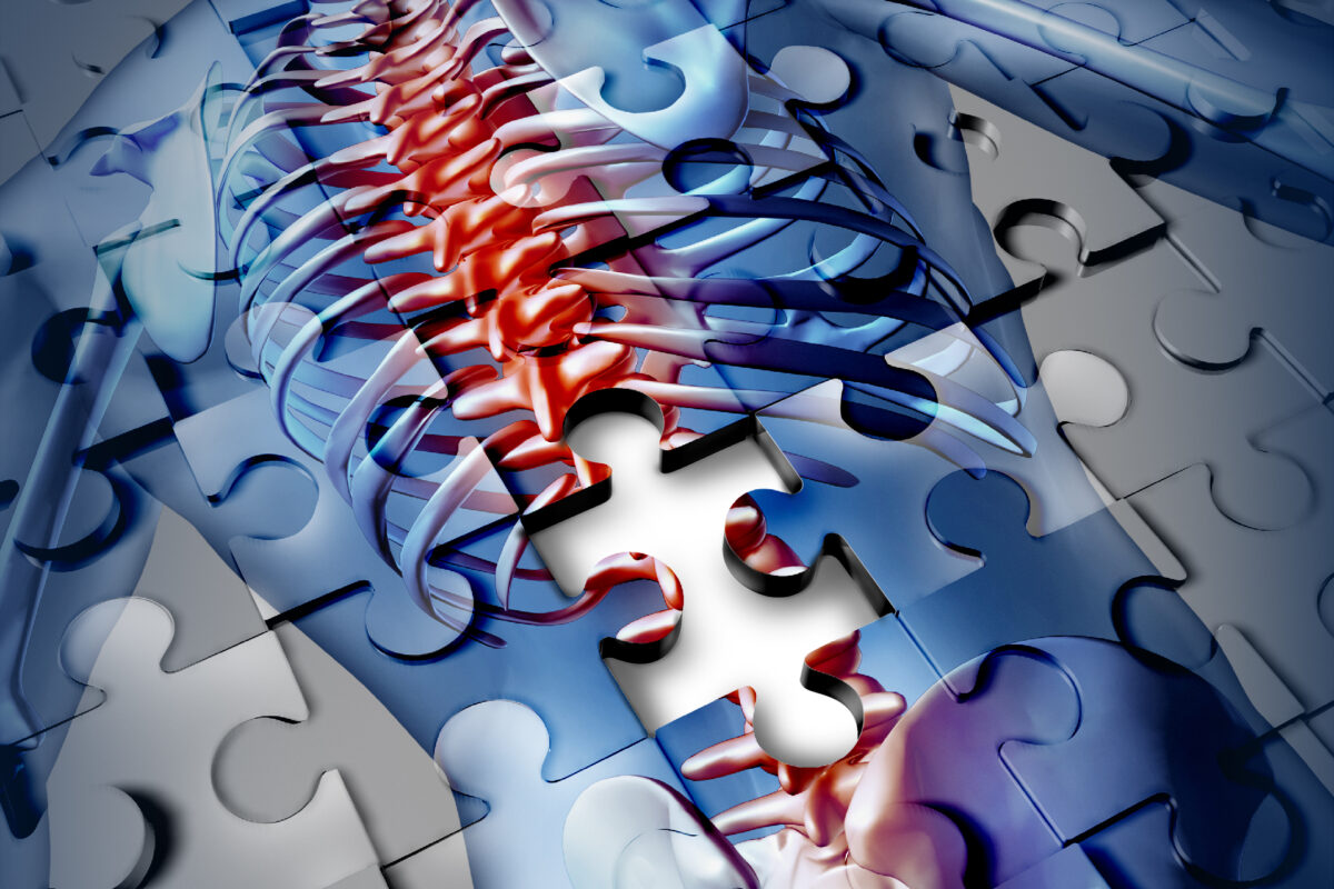New imaging advances transform spinal cord diagnosis, function assessment, care