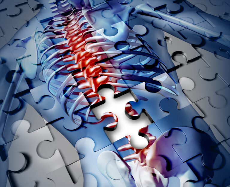 New imaging advances transform spinal cord diagnosis, function assessment, care