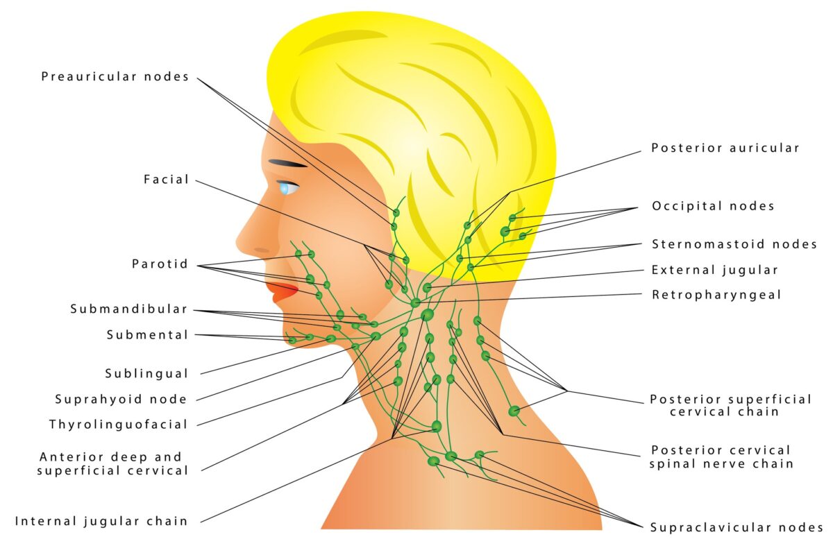 Sentinel lymph node biopsy guides precise staging in oncologic surgery