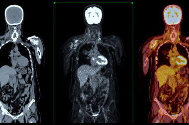 Open MedScience Blog Hub advances medical imaging and healthcare